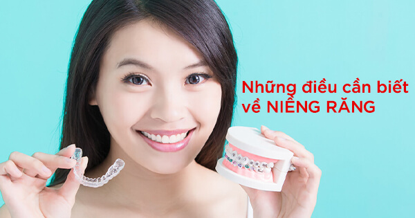 Những Điều Cần Biết Về Niềng Răng