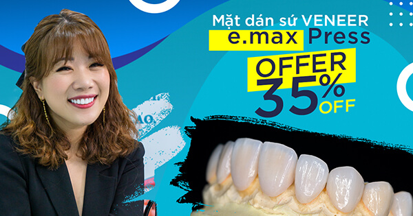 3 tác dụng của mặt dán sứ Veneer cần phải biết để có hàm răng đẹp