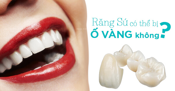 Răng Sứ Có Thể Bị Ố Vàng Không?