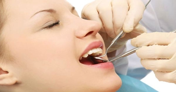 Bọc răng sứ xong bao lâu thì ăn uống bình thường được?