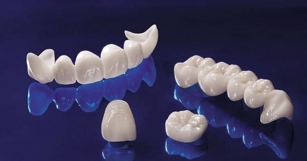 Đừng ham bọc răng sứ giá rẻ nếu không muốn “tiền mất tật mang”