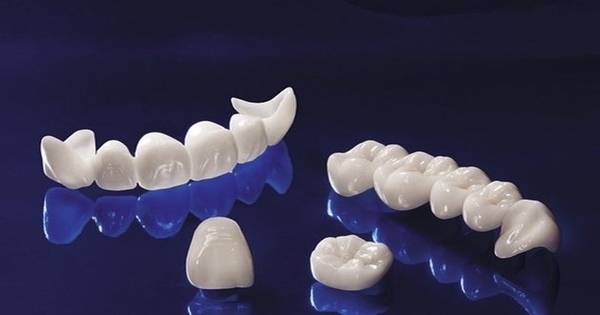 Các loại bọc răng sứ phổ biến hiện nay?