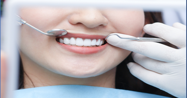 Nguyên nhân gây nên tình trạng cười hở lợi bạn cần biết