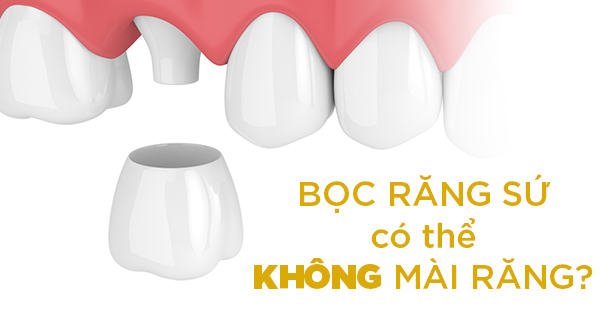 Bọc Răng Sứ Không Cần Mài Răng Có Được Không?