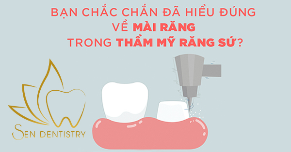 Bạn chắc chắn hiểu đúng về mài răng trong thẩm mỹ răng sứ ?