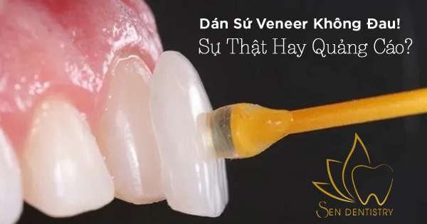 Dán Sứ Veneer Không Đau! Sự Thật Hay Quảng Cáo?