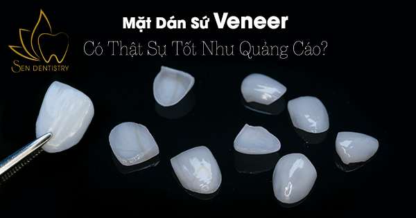 Mặt Dán Sứ Veneer Có Thật Sự Tốt Như Quảng Cáo?