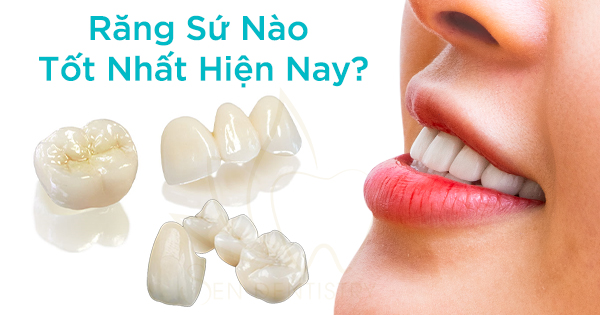 Răng Sứ Nào Tốt Nhất Hiện Nay?