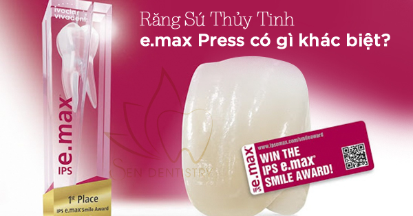 Răng Sứ Thủy Tinh e.max Press Có Gì Khác Biệt?